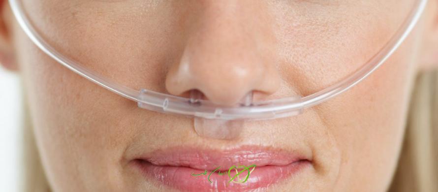 ماسک اکسیژن کانولای بینی معروف به سوند بینی